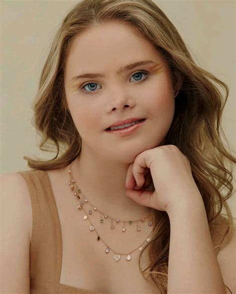 This Teen With Downs Syndrome Has Signed With Modeling Agencies And