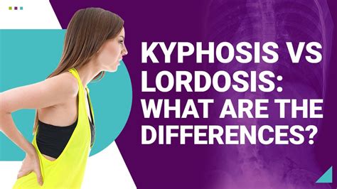 Kyphosis Vs Lordosis What Are The Differences Youtube