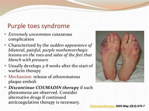 Oral Anticoagulants Ppt