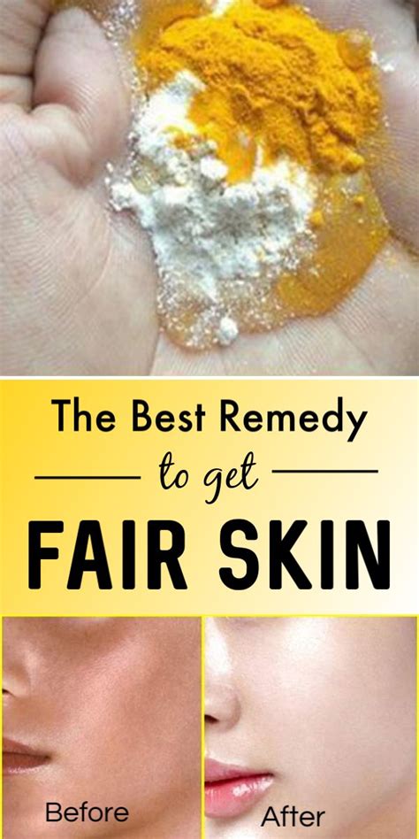 This Is The Best Remedy To Get Fair Skin By Shahnaz Husain Skin