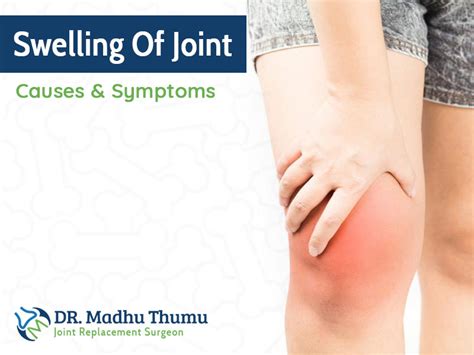 Joint Swelling Causes Symptoms And Treatment