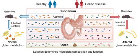 Small Intestinal Microbiome An Understudied Ecosystem In Celiac