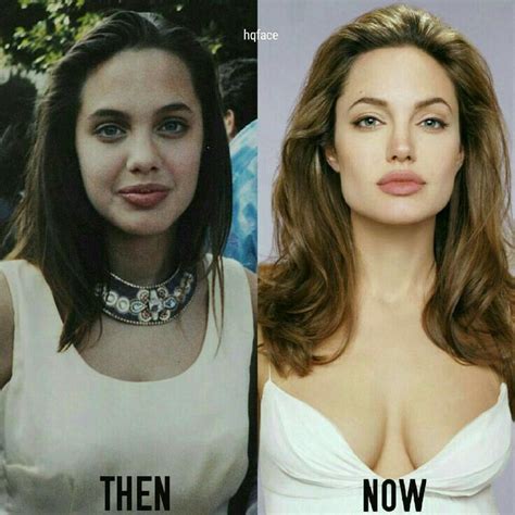 Remember Angelina Jolies Lookalike Who Had A Plastic Surgery To