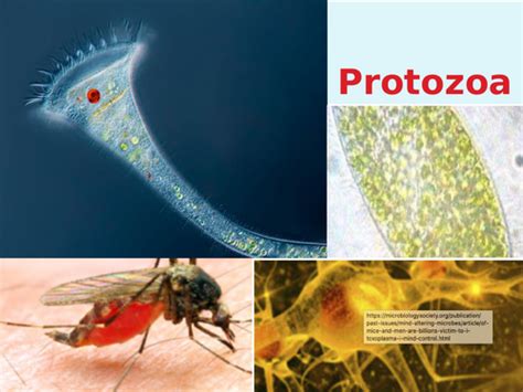 Infectious Diseases Protozoa Teaching Resources