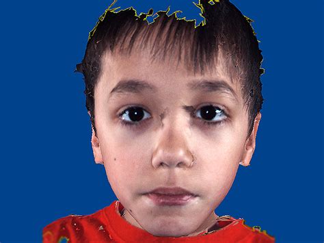 Is It Autism Facial Features That Show Disorder Photo 3 Pictures