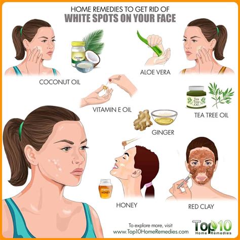 How To Get Rid Of White Spots On Face