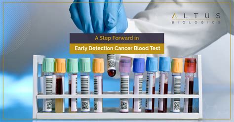 A Step Forward In Early Detection Cancer Blood Test