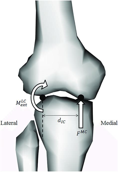 Tibiofemoral Joint Contact Model Tibio Femoral Joint Contact Model
