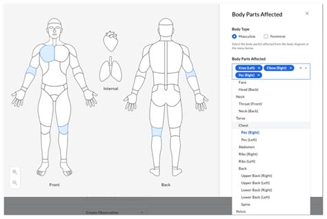 This pdf is a set of parts of the body flashcards. Incidents: Body Diagram Added to 'Body Parts Affected ...