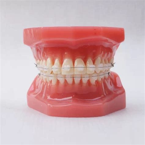 28 Stuks Tanden Orthodontie Keramische Beugel Tandheelkundige Tand