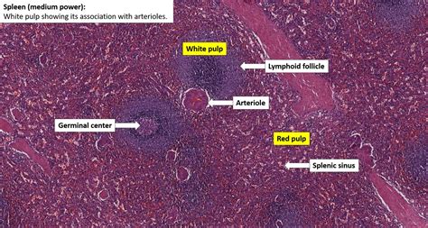 Spleen Normal Histology Nus Pathweb Nus Pathweb