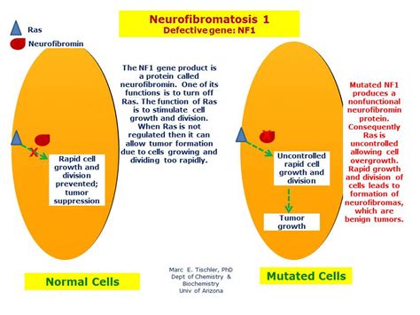 Neurofibromatosis Type 1 Gene