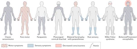 Guillain Barre Syndrome Physiopedia