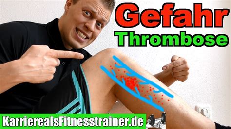 H о 1 u b k. Thrombose: Symptome, Ursachen & Wie Sport machen? Alles ...