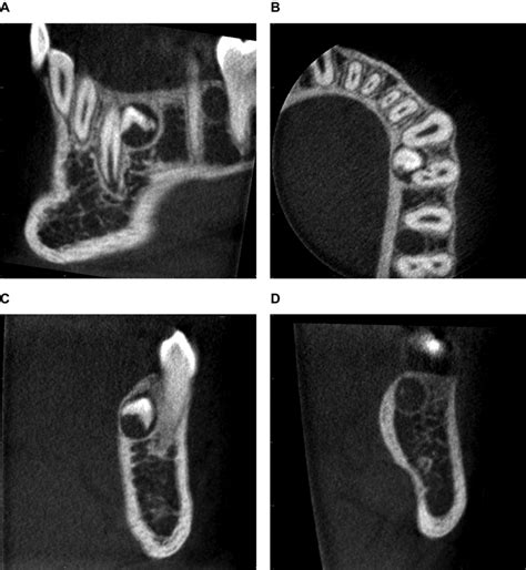 Representative Example Of A Cone Beam Computed Tomography Cbct Scan