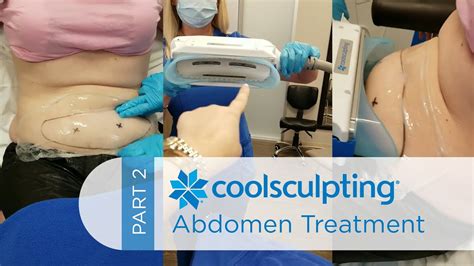 Best Coolsculpting At Home Kit Review Home Co