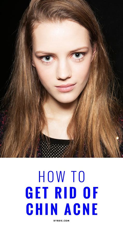 How To Get Rid Of Chin Acne By Hacking Your Hormones Chin Acne Cheek