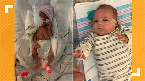 Miracle Baby Born At 22 Weeks Breaks Hospital Record 24thminute