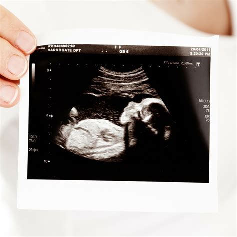 Berikut adalah 10 tanda awal kehamilan yang biasanya. Tanda Hamil: Cara Cek Hamil & Biaya Cek Kehamilan ...