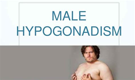 Late Onset Hypogonadism Causes Symptoms Diagnosis And Treatment
