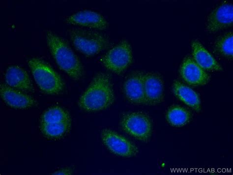 Alpha 2 Macroglobulin Antibody Coralite®488 Cl488 66126
