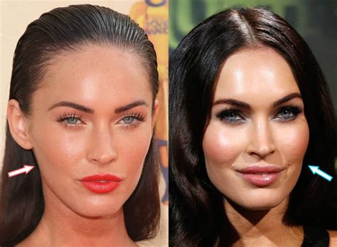 Megan Fox Before And After Plastic Surgery Meme Painted