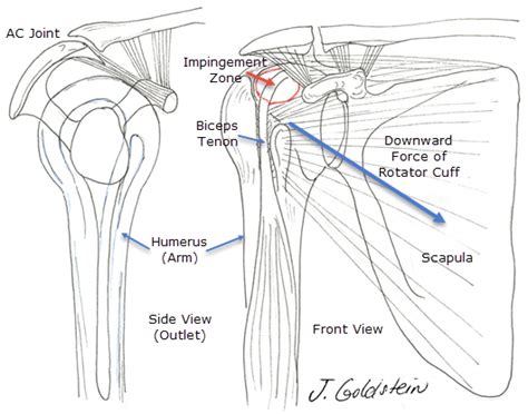 Shoulder Impingement Sports Medicine And Orthopedics
