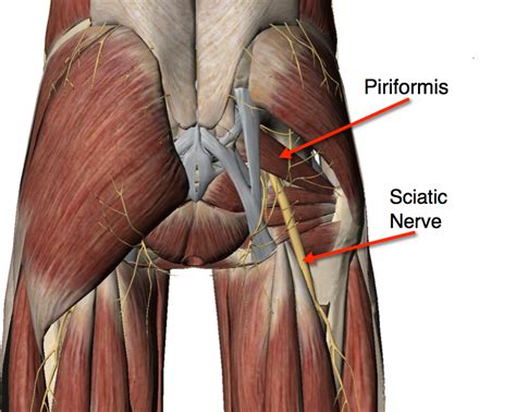 Almost every muscle constitutes one part of a pair of identical bilateral. Is it Sciatica or Piriformis Syndrome? | Jonas