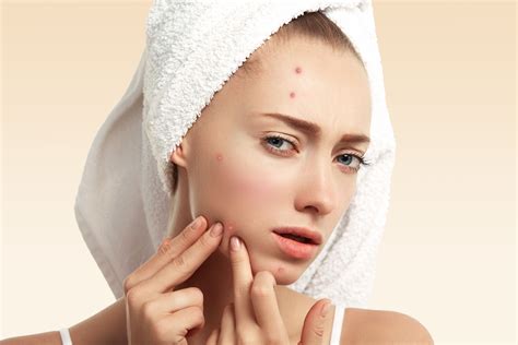 How To Cover A Pimple Scab