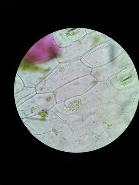 We did not find results for: Epidermal peel - stomata | Plant cell, Stoma