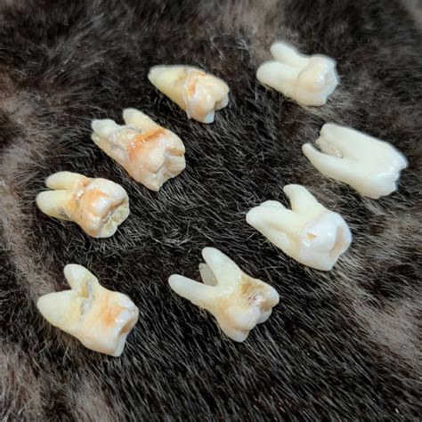 Human Teeth Molars Skullstore Inc