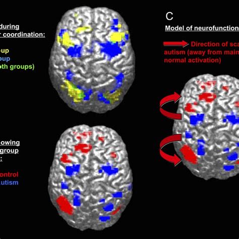 Brain Activation Scattering In Autism Autistic Individuals Show Less