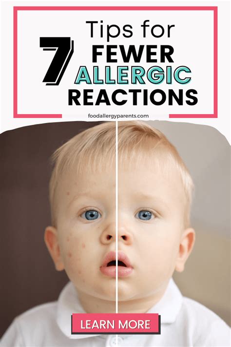 Fewer Allergic Reactions The 7 Prong Approach That Worked Food