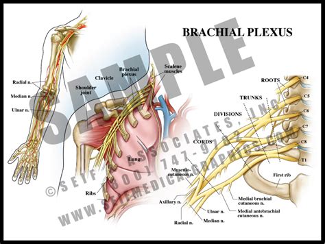 Brachial Plexus Cancer