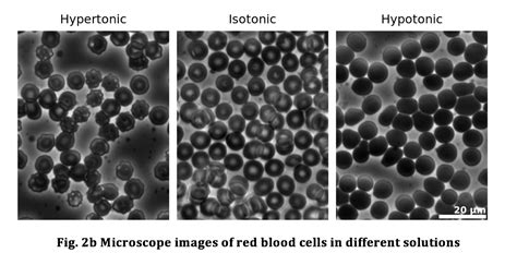 Animal cells have centrosomes (or a pair of centrioles), and lysosomes, whereas plant cells do not. Phospholipids Between Us: (Part 2) Transport through Cell ...