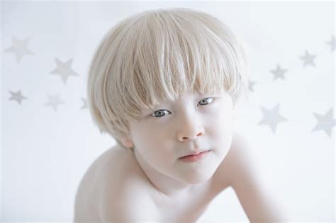 Yulia Taitss Porcelain Beauty Series Albinism Photographs Yulia