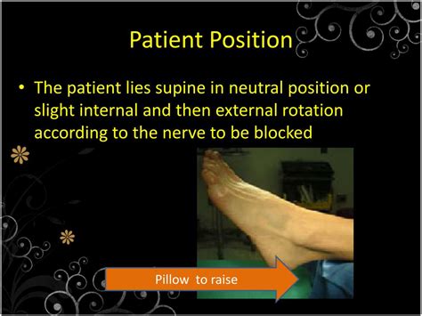 Ppt Ankle Block Powerpoint Presentation Free Download Id2075464