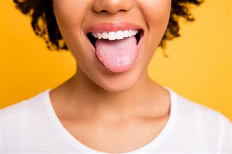 Geographic Tongue Causes Symptoms And Treatment Carifree