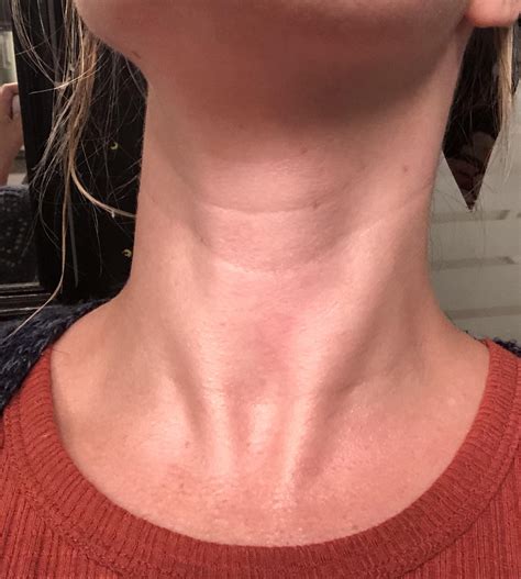 Skin Concerns Ive Started To Develop Some Very Deep Neck Lines Is