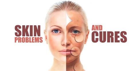 What Can Cause Skin Problems And How To Avoid Them Fitneass