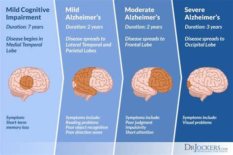 What Causes Alzheimers Disease In The Brain Ellie Matthews Blog