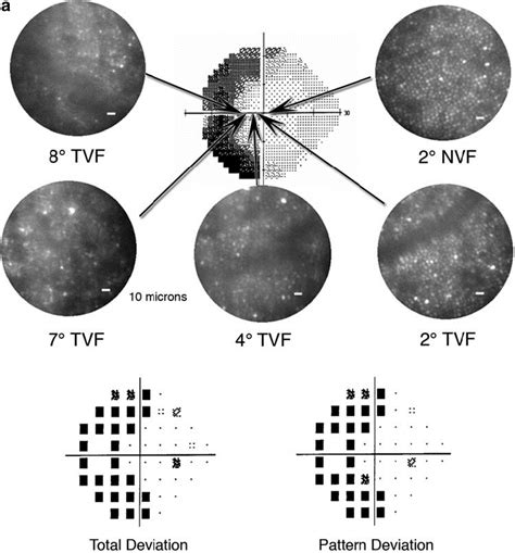The Human Eye And Adaptive Optics Intechopen Optical Coherence