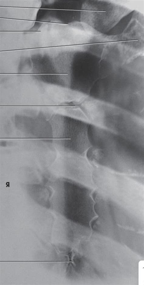 Sternum Label Diagram Quizlet