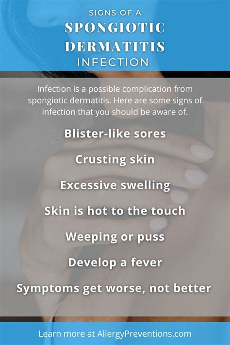 Spongiotic Dermatitis Symptoms Causes Treatments