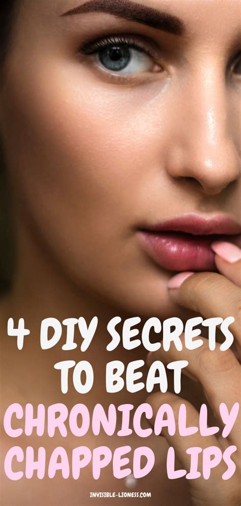 4 Diy Beauty Tips To Combat Chronic Chapped Lips In 2020 Cure For