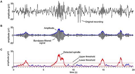 Frontiers | Sleep spindle and slow wave frequency reflect motor skill