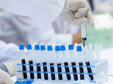 New Blood Test Can Detect Cancer Before Any Symptoms Show The