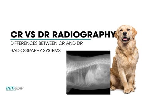 The Difference Between Cr And Dr Radiography Intriquip