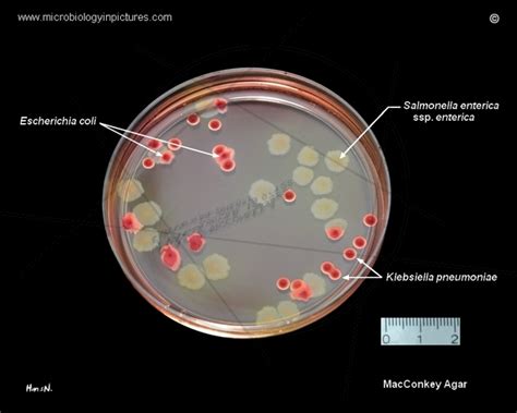 Macconkey Agar Plate With Salmonella Escherichia And Klebsiella