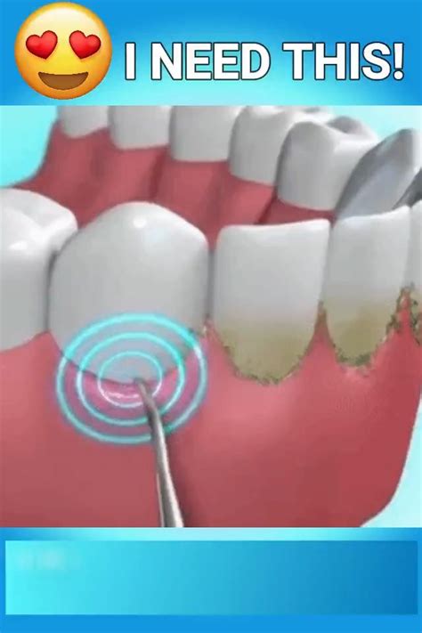 Feel Confident With Pearly White Smile Healthy Teeth And Gum Video
